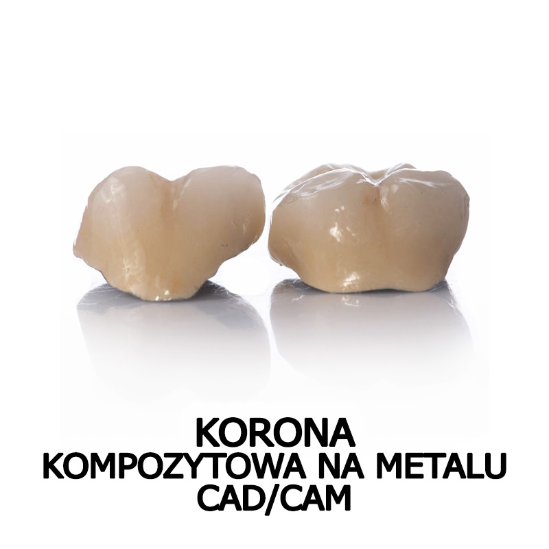 korona kompozytowa na metalu cad/cam
