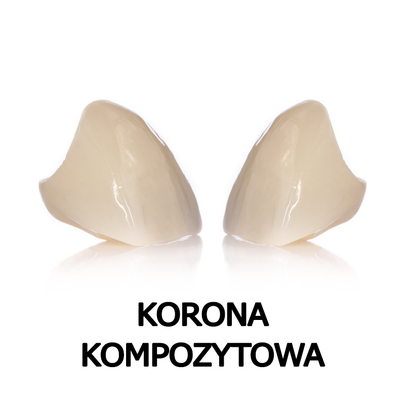 Korona kompozytowa